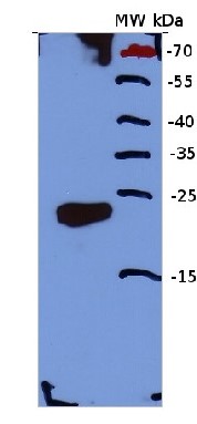 Calcineurin/EF-hand motif  in the group Antibodies for Plant/Algal  / Developmental Biology / Signal transduction at Agrisera AB (Antibodies for research) (AS13 2666)